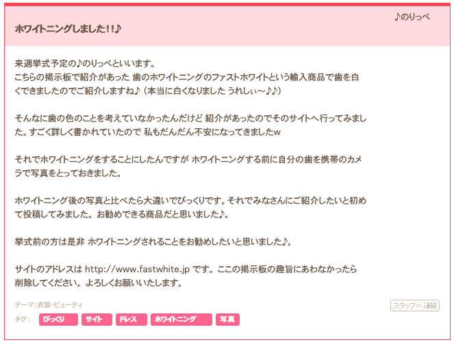 ホワイトニング体験談
