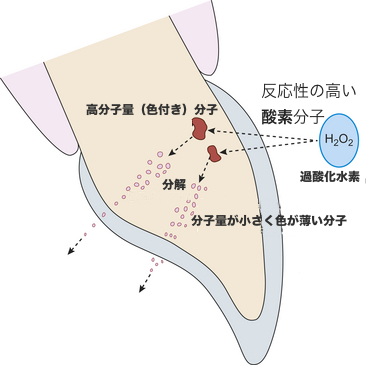 過酸化水素によるホワイトニングのメカニズム