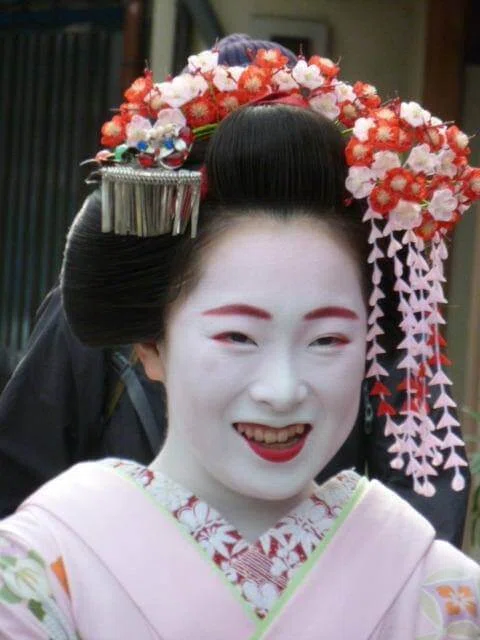 肌が白いと歯の黄ばみが目立ちます